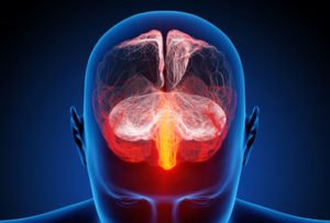 living with pain on the brain
