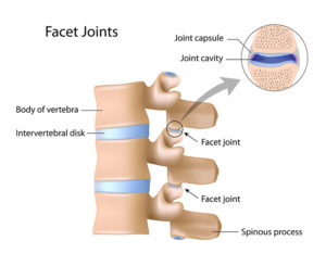 facet joint