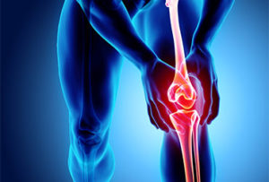 osteoarthritis knee