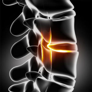 spine disc