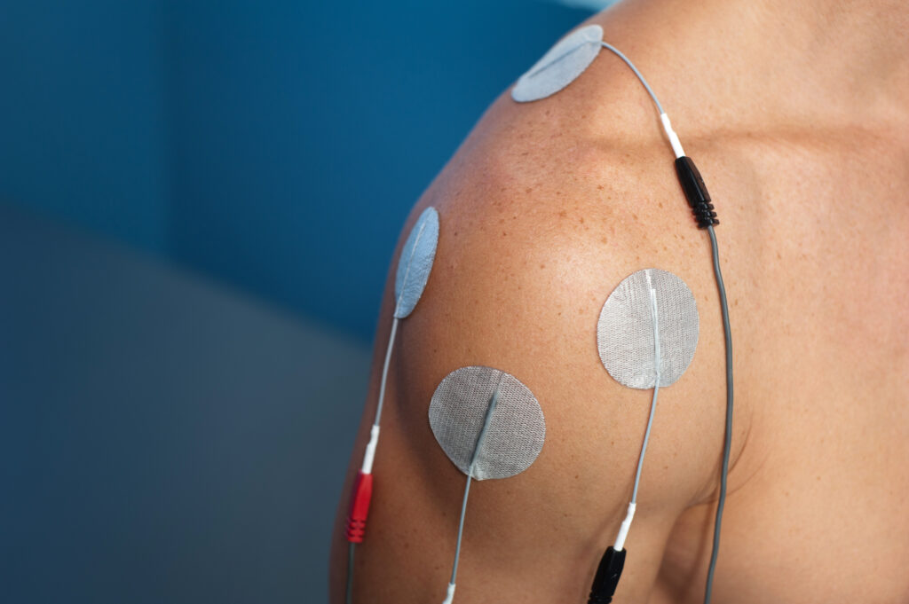 Treatment of a male patient managing shoulder pain post-surgery using H-Wave Device Stimulation (HWDS) for pain management.
